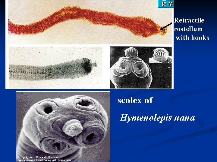 Retractile rostellum with hooks scolex of Hymenolepis nana 