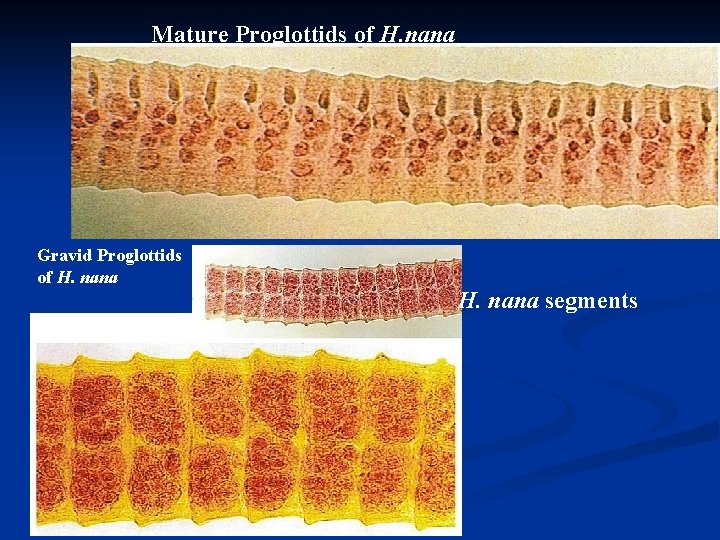 Mature Proglottids of H. nana Gravid Proglottids of H. nana segments 