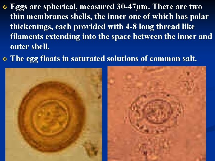 Eggs are spherical, measured 30 -47µm. There are two thin membranes shells, the inner