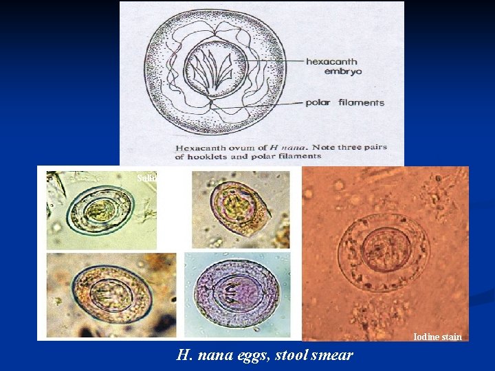 Saline s. Iodine stain H. nana eggs, stool smear 