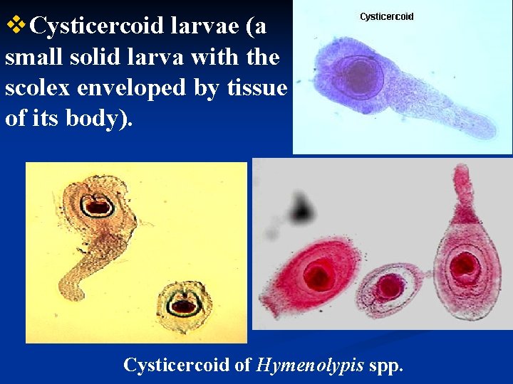 v. Cysticercoid larvae (a small solid larva with the scolex enveloped by tissue of