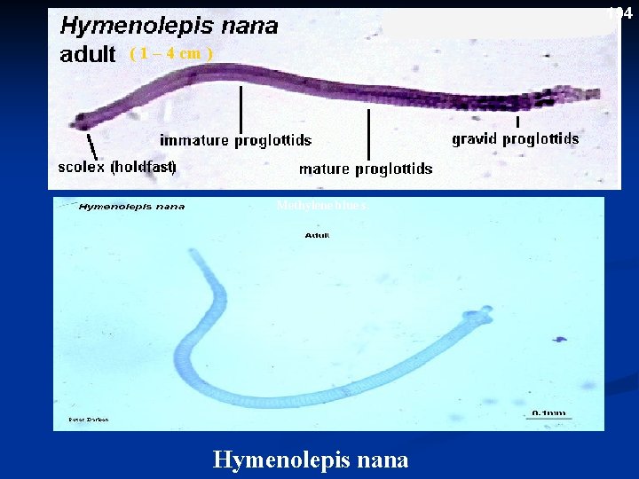 194 ( 1 – 4 cm ) Methylene blue s. Hymenolepis nana 