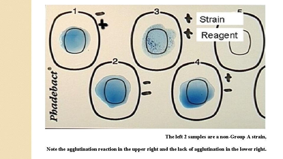 The left 2 samples are a non-Group A strain, Note the agglutination reaction in