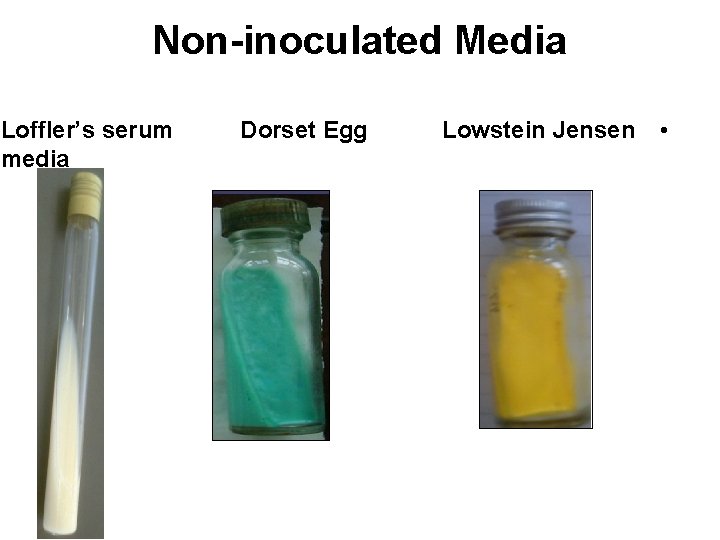 Non-inoculated Media Loffler’s serum media Dorset Egg Lowstein Jensen • 