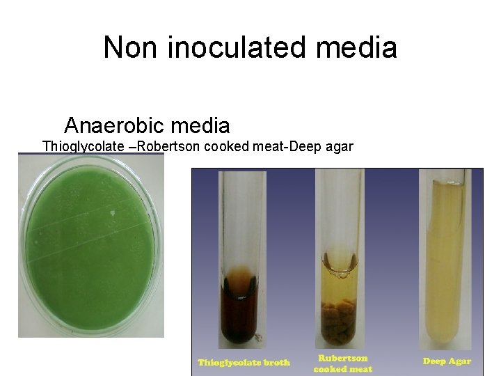 Non inoculated media Anaerobic media Thioglycolate –Robertson cooked meat-Deep agar 
