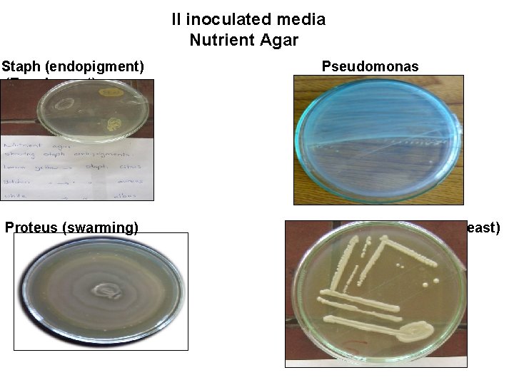 II inoculated media Nutrient Agar Staph (endopigment) (Exopigment) Proteus (swarming) Pseudomonas Sabroud dextrose (yeast)