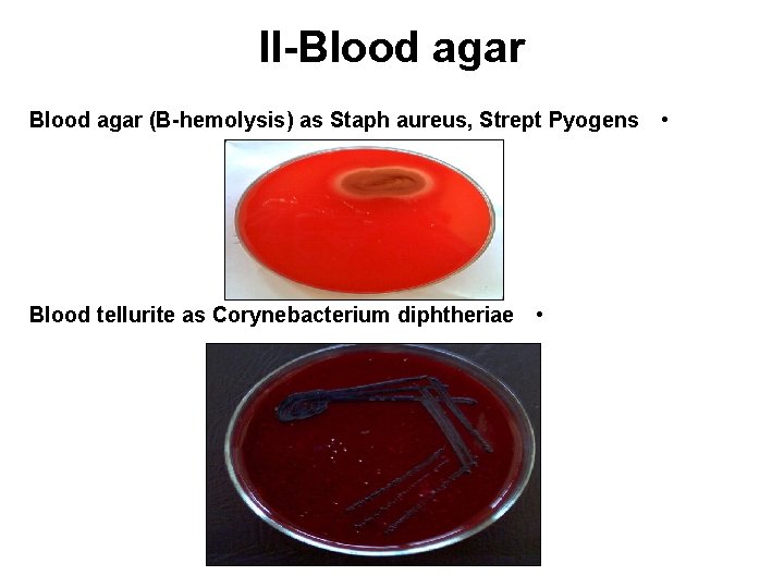 II-Blood agar (B-hemolysis) as Staph aureus, Strept Pyogens • Blood tellurite as Corynebacterium diphtheriae