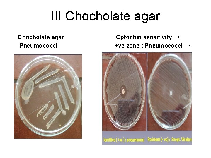III Chocholate agar Pneumococci Optochin sensitivity • + ve zone : Pneumococci • -