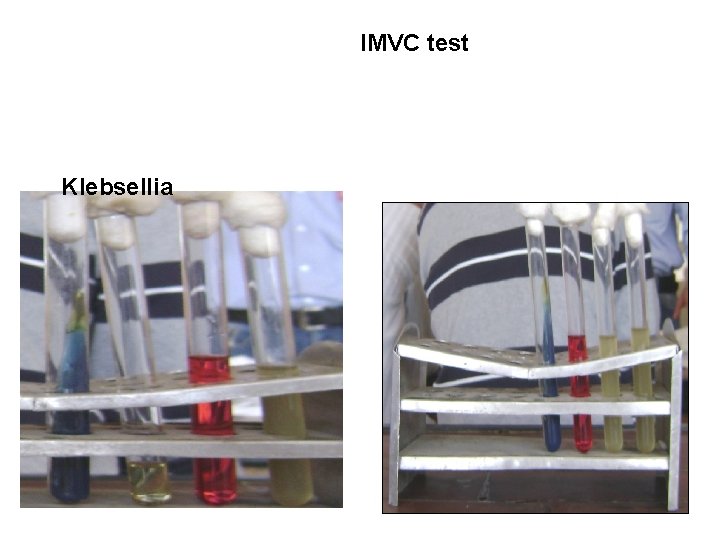 IMVC test Klebsellia 