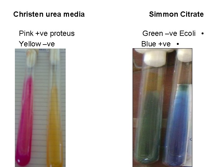 Christen urea media Pink +ve proteus Yellow –ve Klebellia Simmon Citrate Green –ve Ecoli