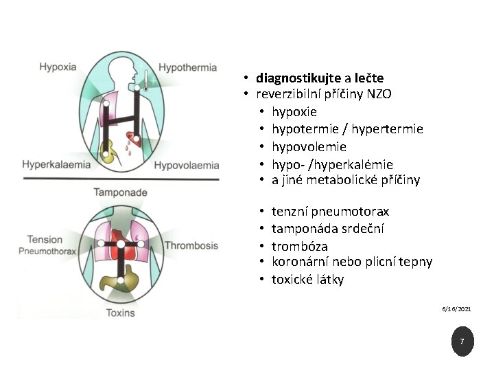 Během KPR • diagnostikujte a lečte • reverzibilní příčiny NZO • hypoxie • hypotermie