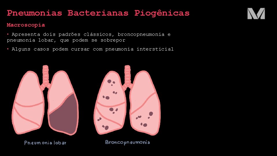 Pneumonias Bacterianas Piogênicas Macroscopia • Apresenta dois padrões clássicos, broncopneumonia e pneumonia lobar, que