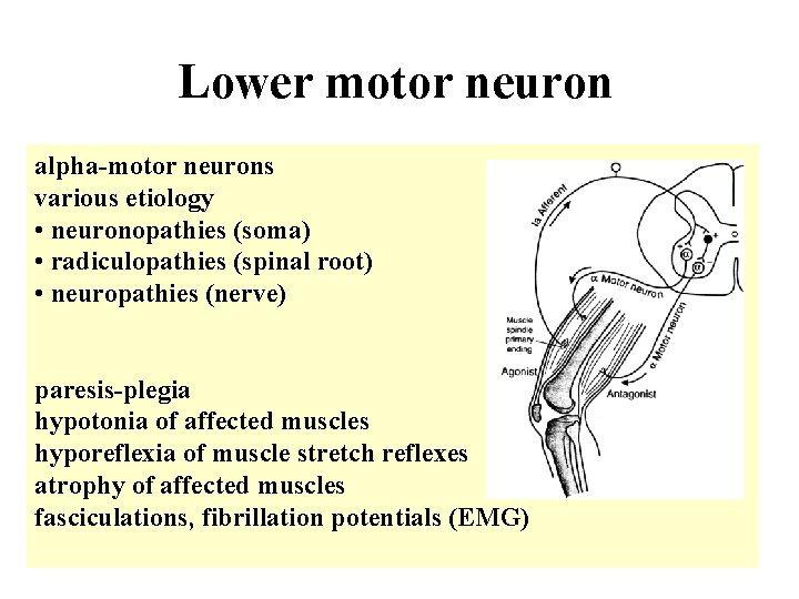 Lower motor neuron alpha-motor neurons various etiology • neuronopathies (soma) • radiculopathies (spinal root) Lower motor neuron alpha-motor neurons various etiology • neuronopathies (soma) • radiculopathies (spinal root)