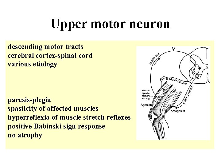 Upper motor neuron descending motor tracts cerebral cortex-spinal cord various etiology paresis-plegia spasticity of
