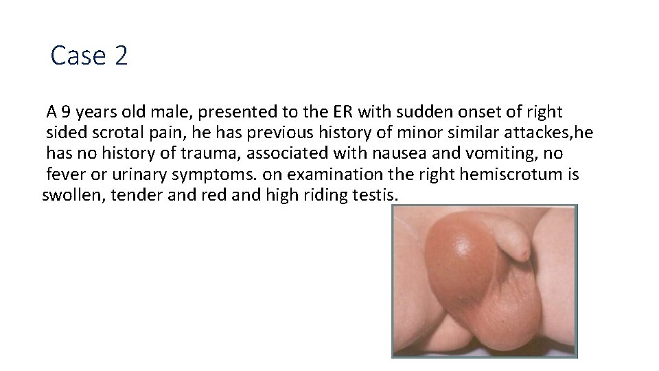 Case 2 A 9 years old male, presented to the ER with sudden onset