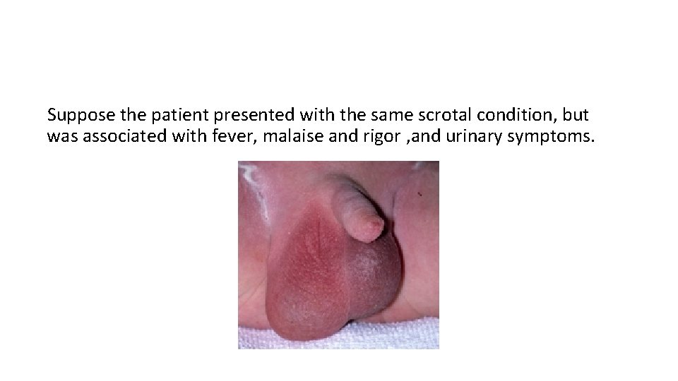 Suppose the patient presented with the same scrotal condition, but was associated with fever,