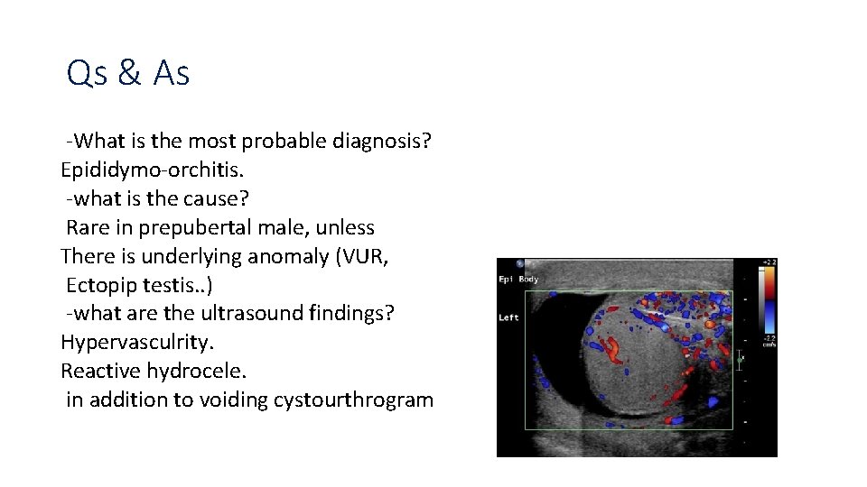 Qs & As -What is the most probable diagnosis? Epididymo-orchitis. -what is the cause?