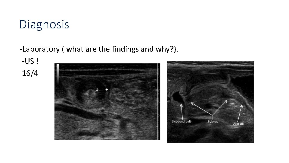 Diagnosis -Laboratory ( what are the findings and why? ). -US ! 16/4 