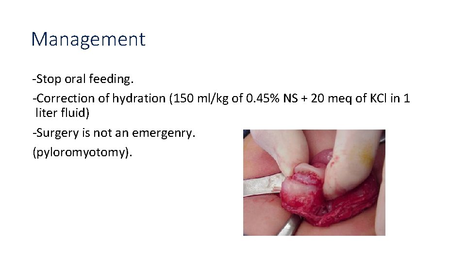 Management -Stop oral feeding. -Correction of hydration (150 ml/kg of 0. 45% NS +