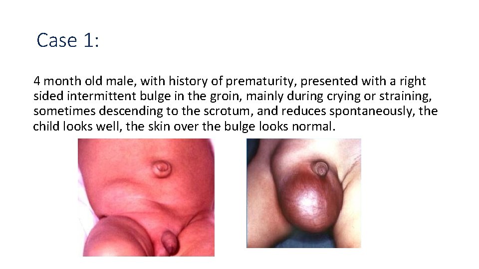 Case 1: 4 month old male, with history of prematurity, presented with a right