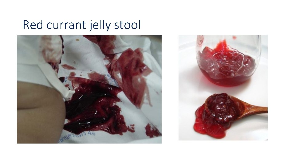 Red currant jelly stool 
