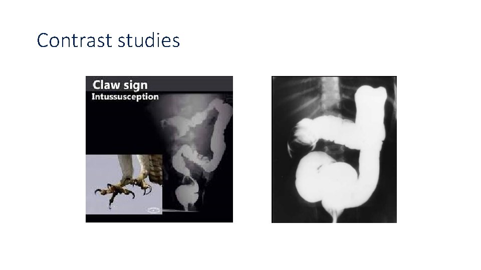 Contrast studies 