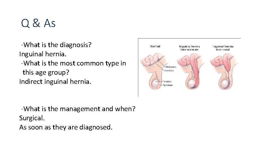 Q & As -What is the diagnosis? Inguinal hernia. -What is the most common