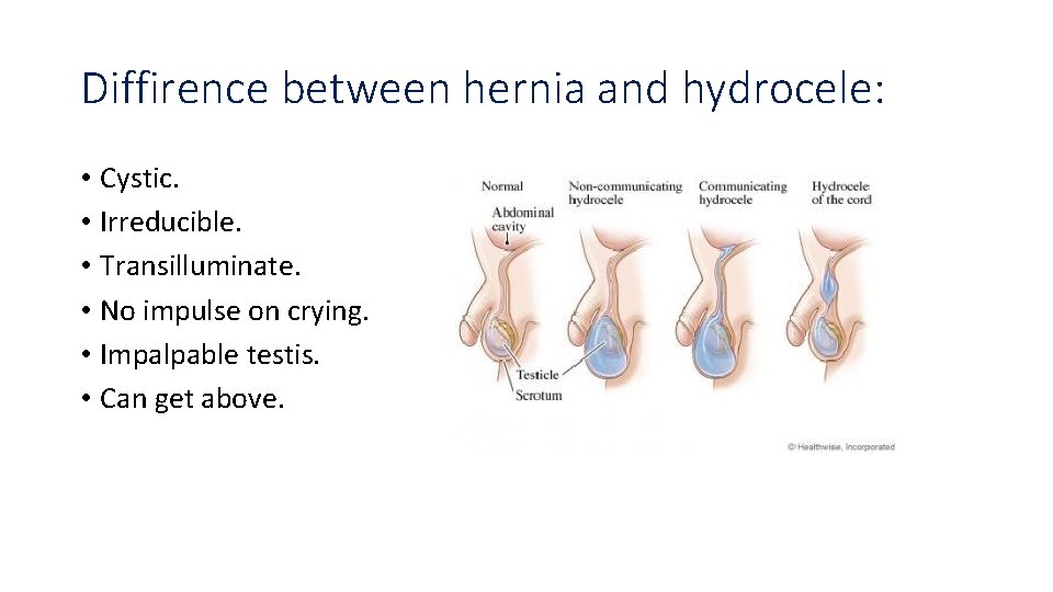 Diffirence between hernia and hydrocele: • Cystic. • Irreducible. • Transilluminate. • No impulse