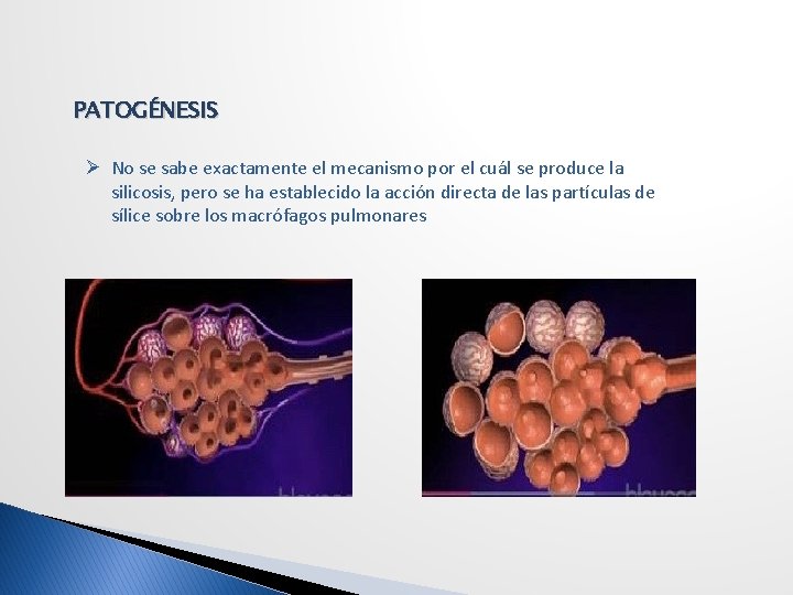 PATOGÉNESIS Ø No se sabe exactamente el mecanismo por el cuál se produce la