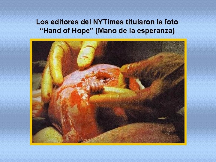 Los editores del NYTimes titularon la foto “Hand of Hope” (Mano de la esperanza)