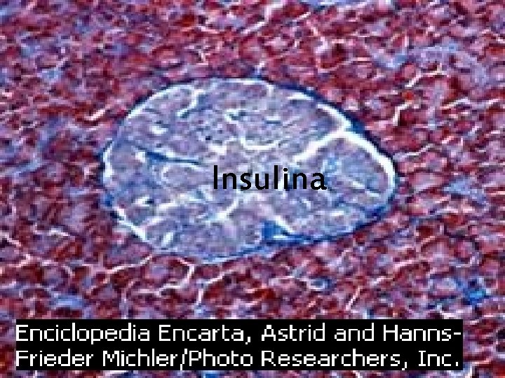 Insulina 