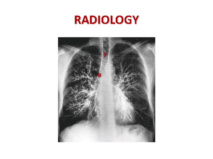 RADIOLOGY T B 