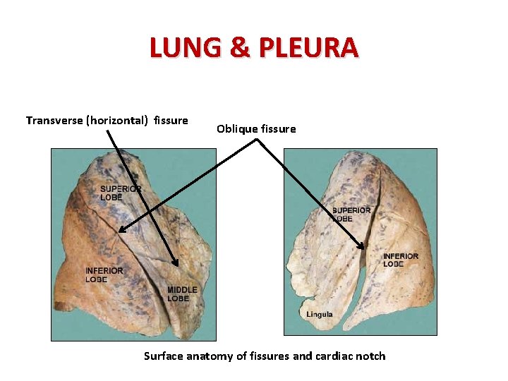 LUNG & PLEURA Transverse (horizontal) fissure Oblique fissure Surface anatomy of fissures and cardiac