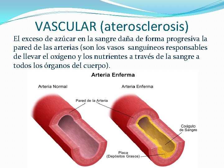 VASCULAR (aterosclerosis) El exceso de azúcar en la sangre daña de forma progresiva la