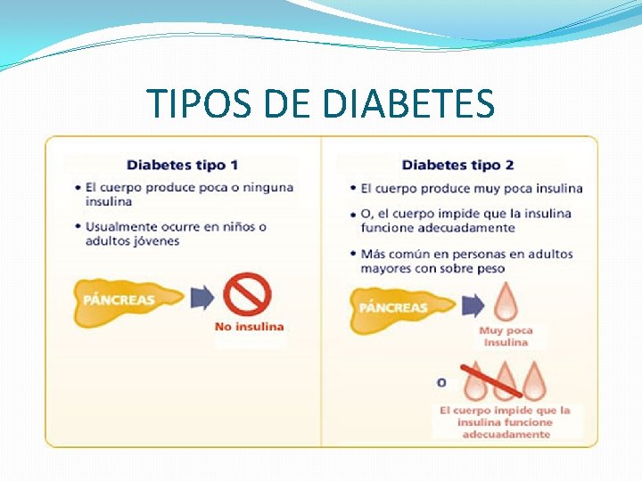 TIPOS DE DIABETES 
