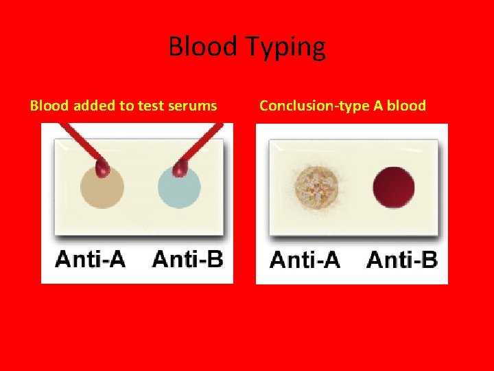Blood Typing Blood added to test serums Conclusion-type A blood 