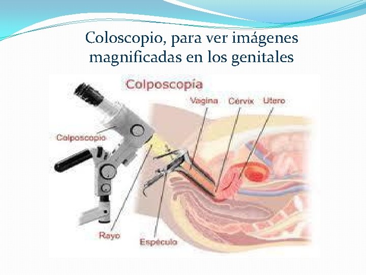 Coloscopio, para ver imágenes magnificadas en los genitales 