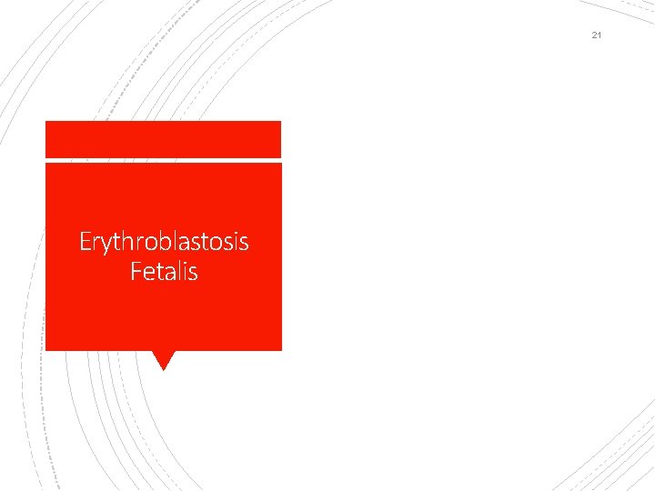 21 Erythroblastosis Fetalis 