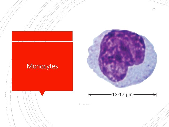 31 Monocytes Dennis Strete 