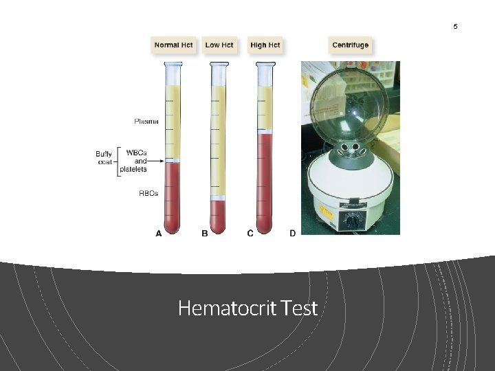 5 Hematocrit Test 