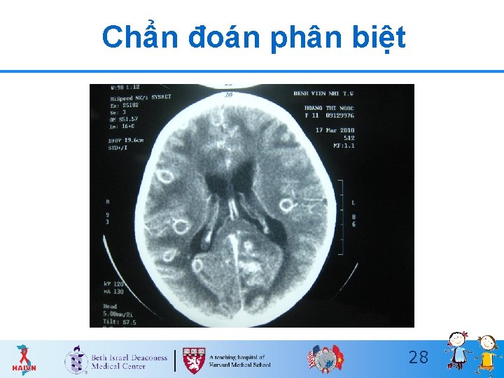 Chẩn đoán phân biệt 28 