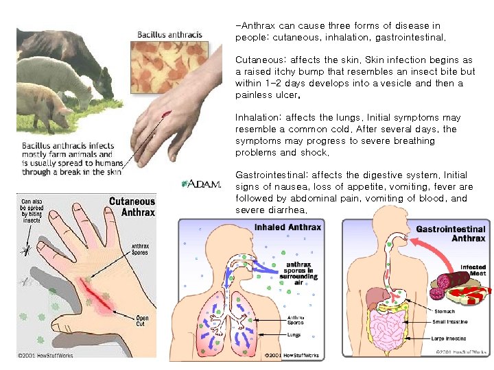 -Anthrax can cause three forms of disease in people: cutaneous, inhalation, gastrointestinal. Cutaneous: affects