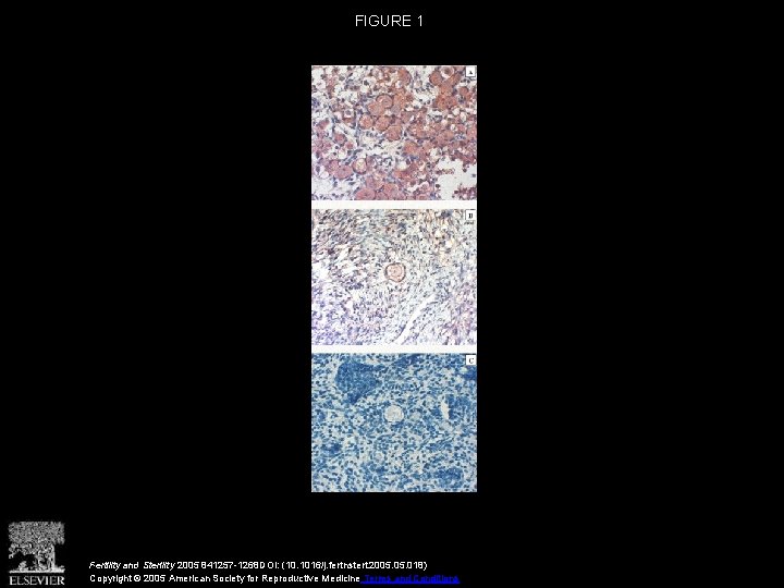 FIGURE 1 Fertility and Sterility 2005 841257 -1268 DOI: (10. 1016/j. fertnstert. 2005. 018)