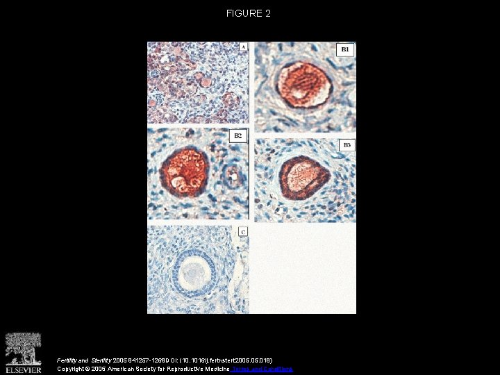 FIGURE 2 Fertility and Sterility 2005 841257 -1268 DOI: (10. 1016/j. fertnstert. 2005. 018)