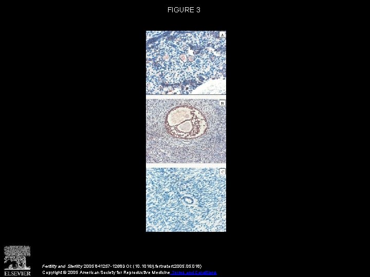 FIGURE 3 Fertility and Sterility 2005 841257 -1268 DOI: (10. 1016/j. fertnstert. 2005. 018)