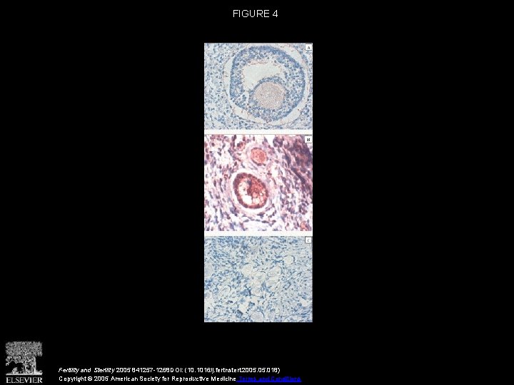 FIGURE 4 Fertility and Sterility 2005 841257 -1268 DOI: (10. 1016/j. fertnstert. 2005. 018)