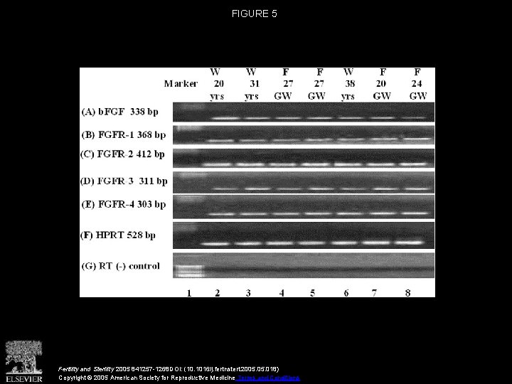 FIGURE 5 Fertility and Sterility 2005 841257 -1268 DOI: (10. 1016/j. fertnstert. 2005. 018)