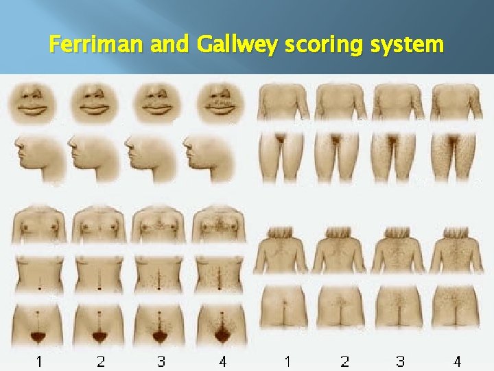 Ferriman and Gallwey scoring system 