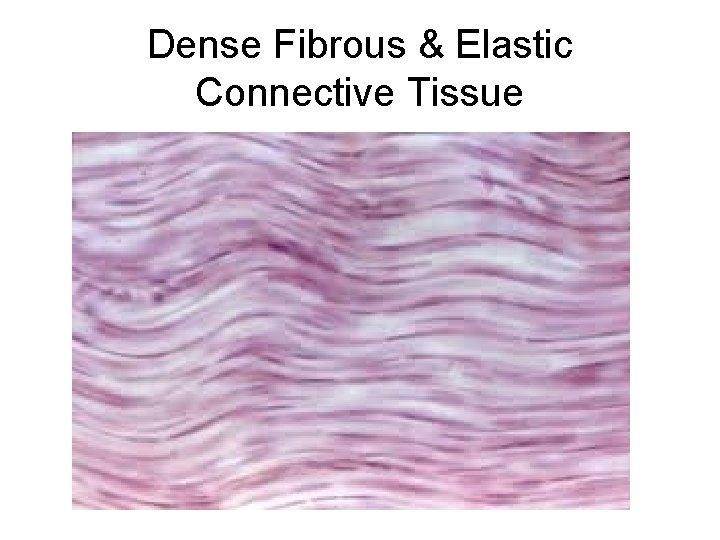 Dense Fibrous & Elastic Connective Tissue 