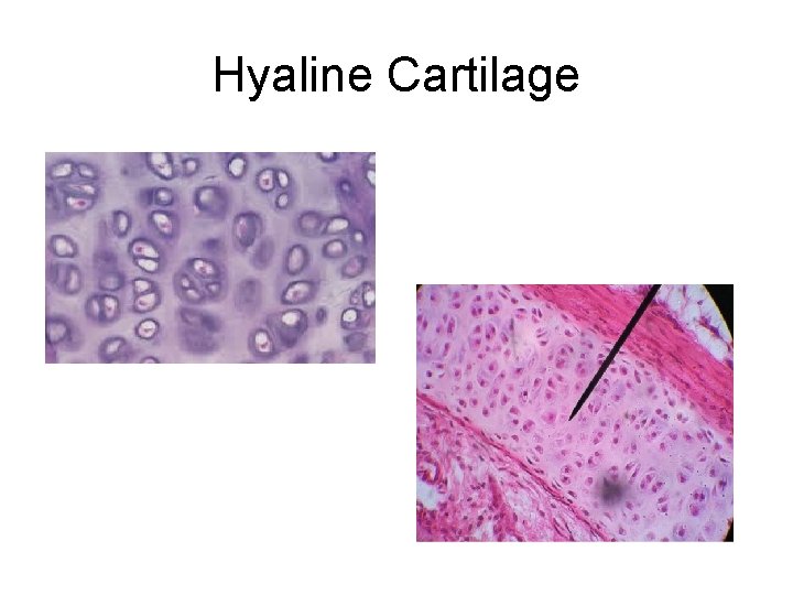 Hyaline Cartilage Hyaline Cartilage